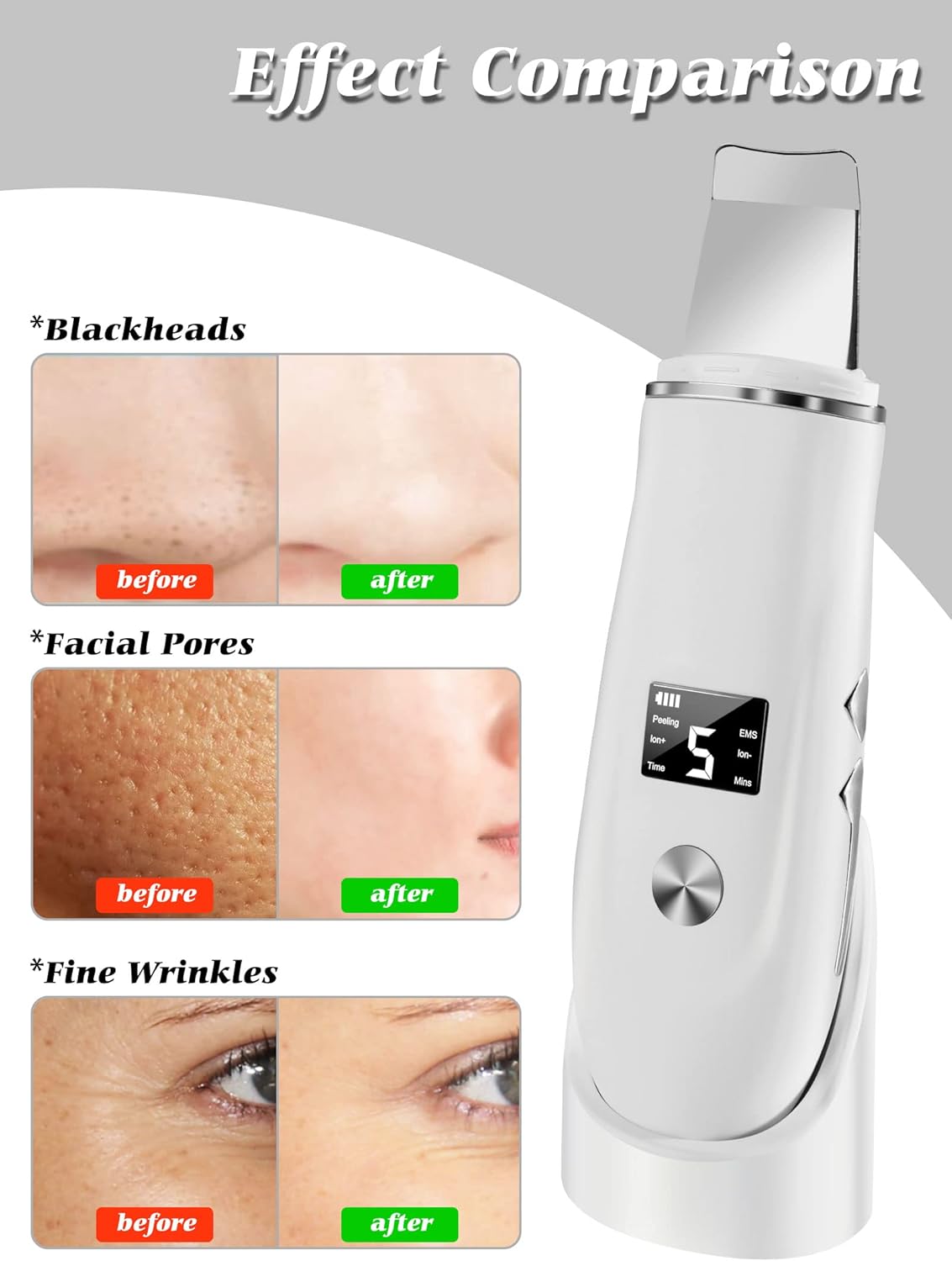 Ultrasonic Facial Skin Scrubber and Pore Cleaner - 12