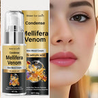 Water Ice Levin Bee Venom Skin Repair Cream with Salicylic Acid 30g