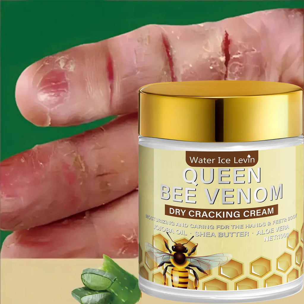 Queen Bee Venom Repair Cream Dry Skin Moisturizer for Hands and Feet