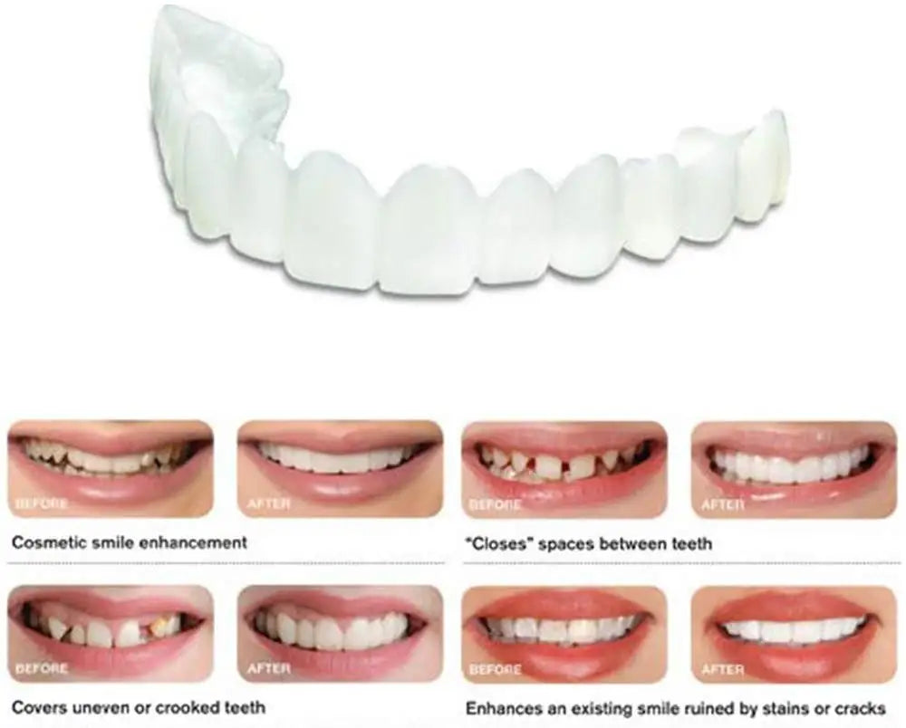 Snap On Smile Veneers Cosmetic Teeth Whitening Denture Set