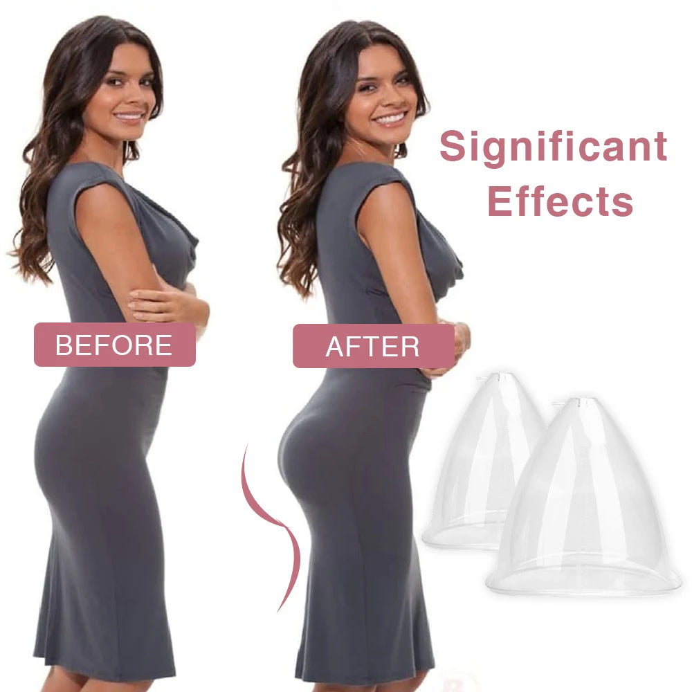 Vacuum Massage Cups for Breast and Buttock Lifting