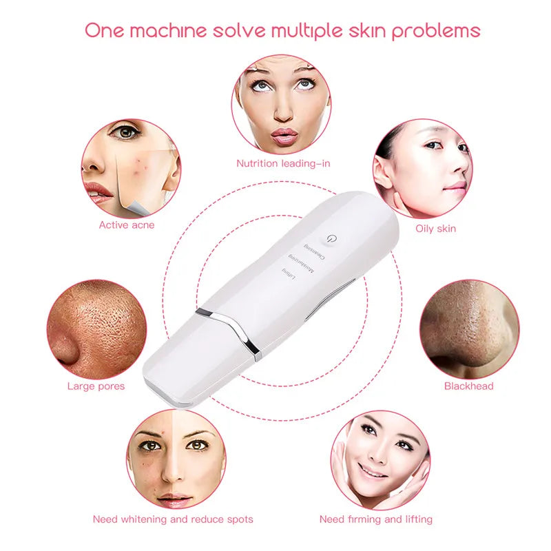 Ultrasonic Facial Skin Scrubber and Deep Pore Cleansing Spatula