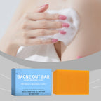 Turmeric Bar Soap for Back and Body Acne Treatment and Skin Brightening