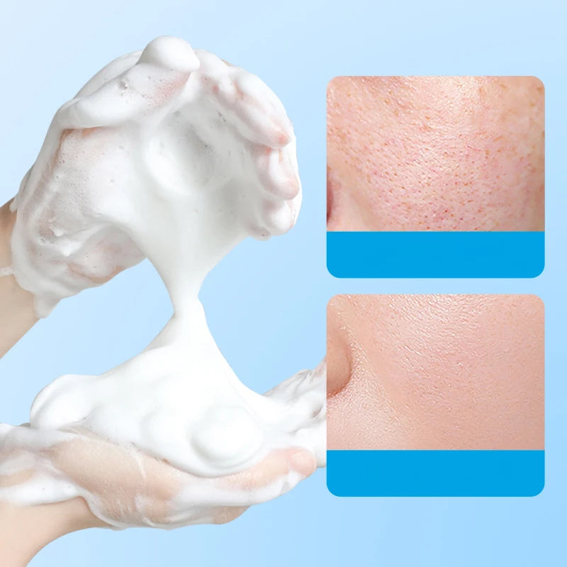 Sadoer Goat Milk Essence Soap Moisturizing Facial and Body Cleansing Bar