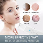Ultrasonic Skin Scrubber Facial Pore Cleaner Blackhead Remover Device
