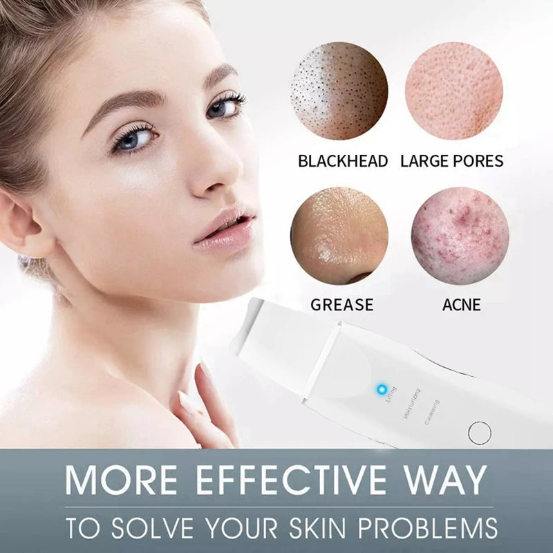 Ultrasonic Skin Scrubber Facial Pore Cleaner Blackhead Remover Device