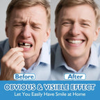 Flexible Silicone Denture Set for Natural Smile and Comfort Fit