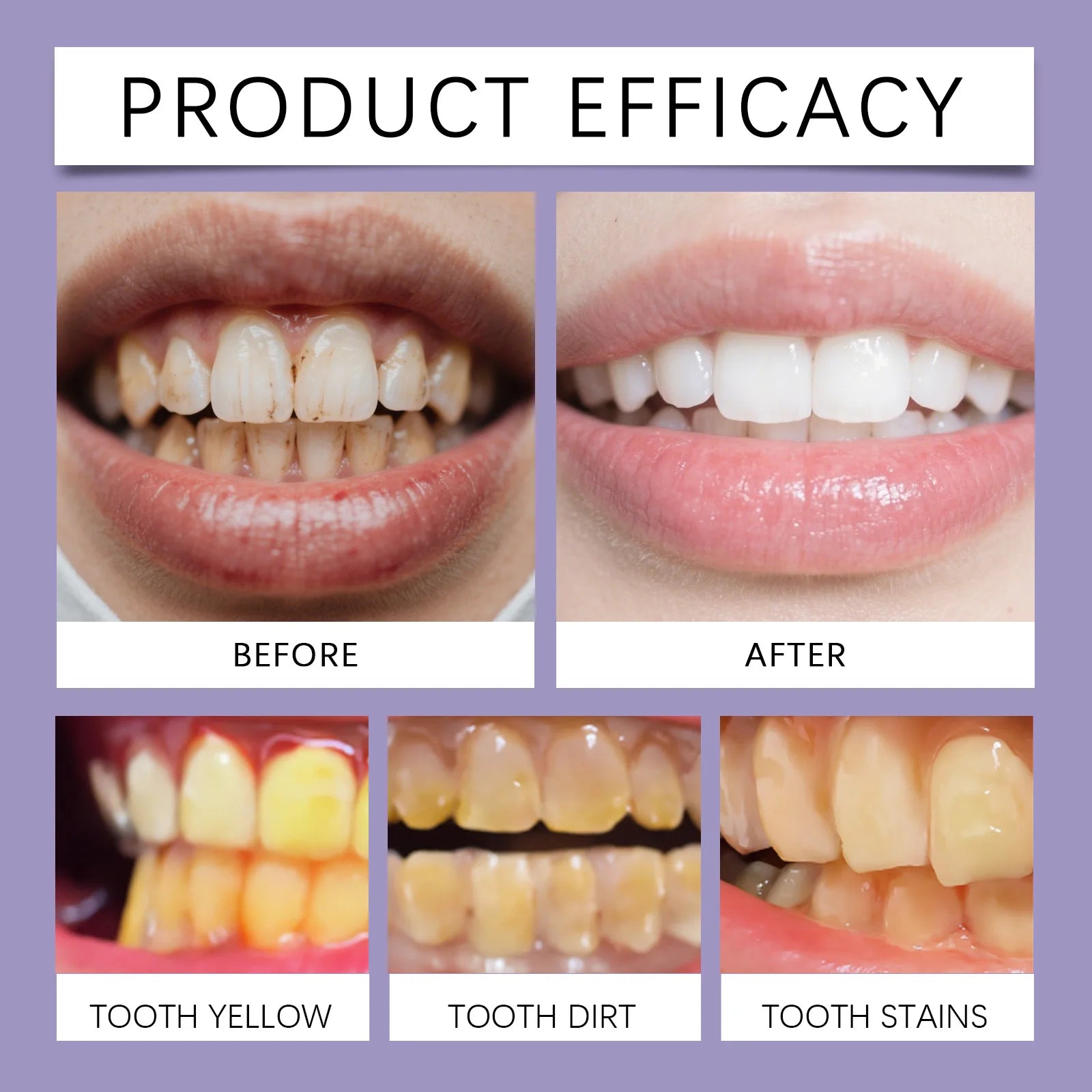 Bee Venom Gum Care Whitening Toothpaste - 11