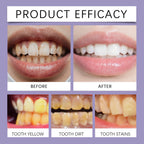 Bee Venom Gum Care Whitening Toothpaste