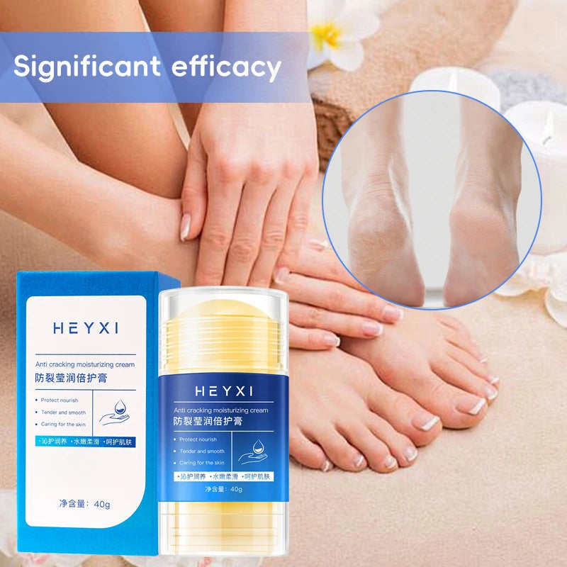 Heyxi Moisturizing Repair Balm Anti Cracking Cream for Hands and Feet