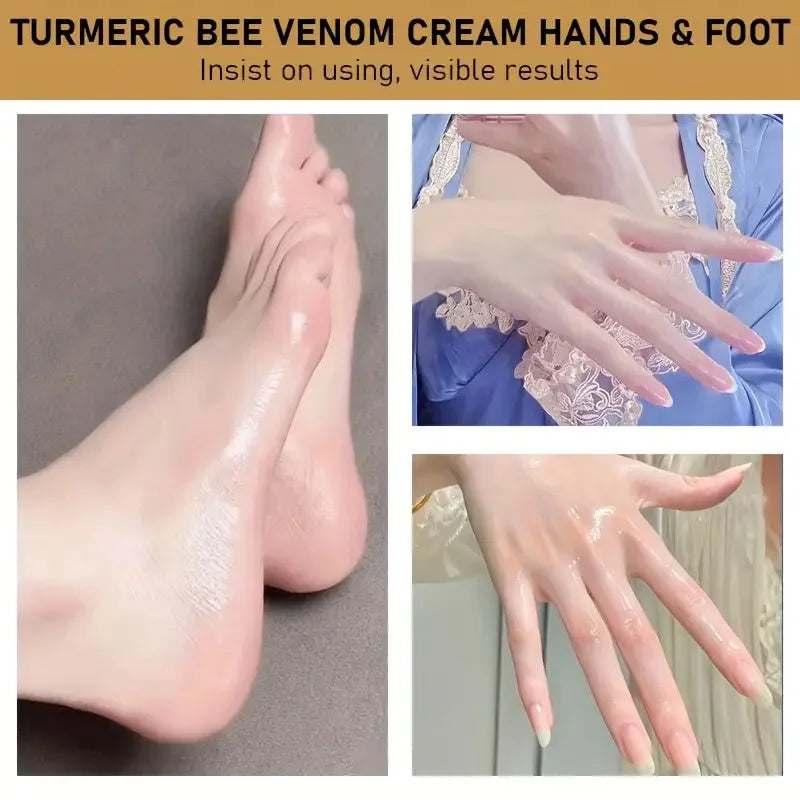 YUITIKUE Lanolin Hand and Foot Cream Repair Moisturizer for Dry Skin