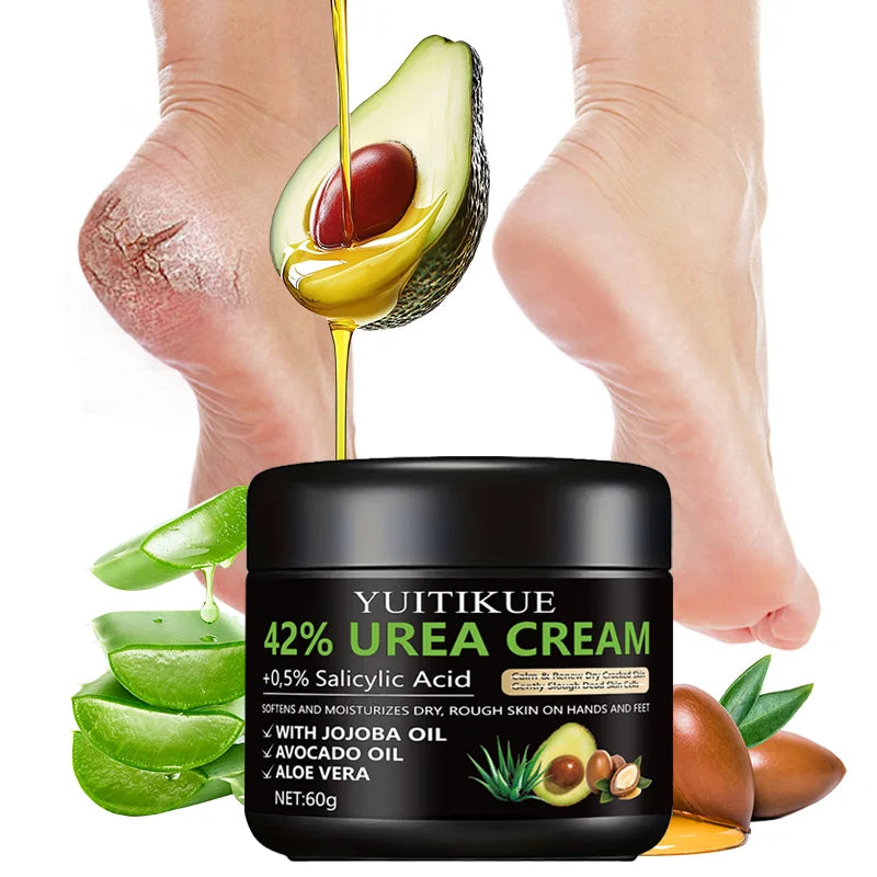 YUITIKUE 42% Urea Foot Cream for Cracked Heels and Dry Skin Repair - 1