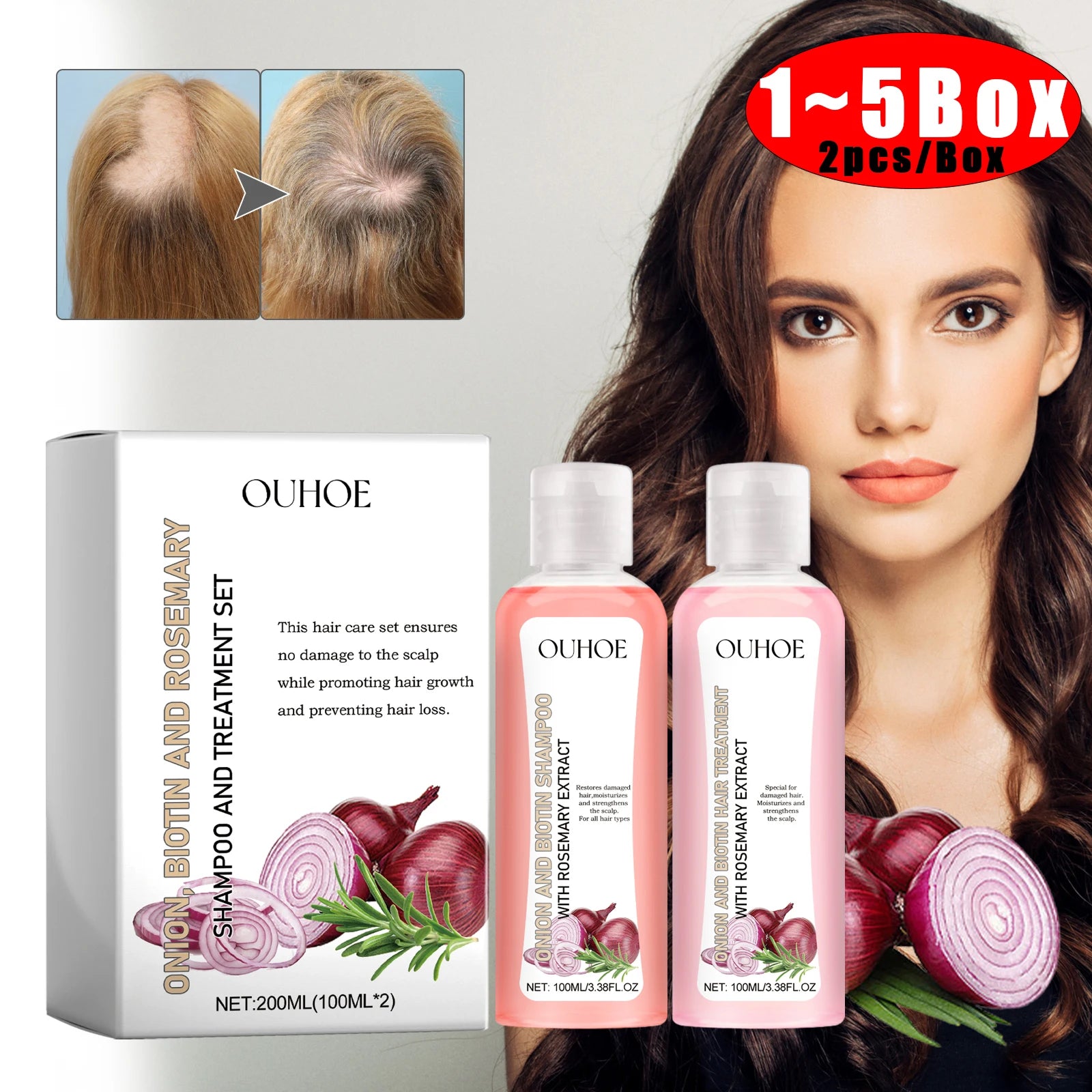 Biotin and Rosemary Onion Extract Hair Shampoo and Conditioner Set