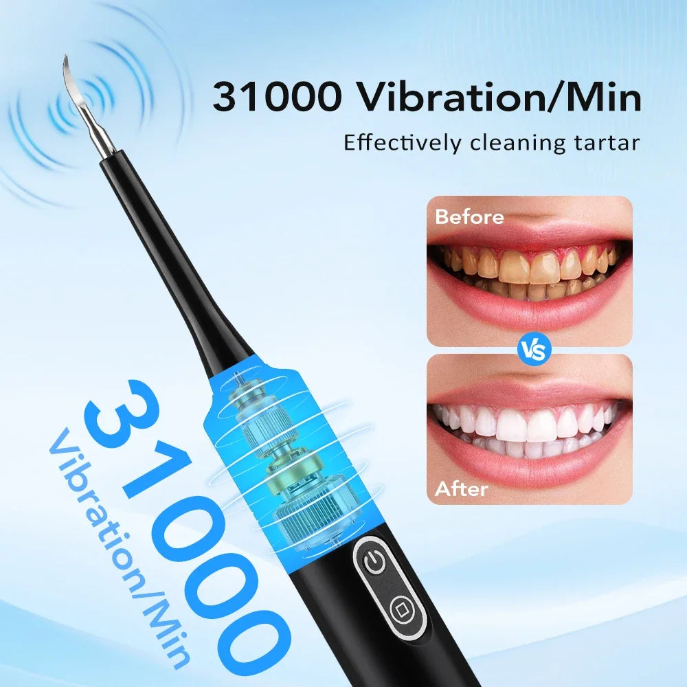 Electric Sonic Teeth Whitening and Plaque Removal Kit - 3