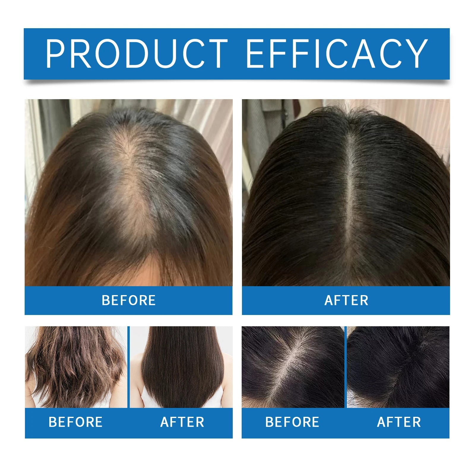 Rosemary Scalp Stimulating Hair Growth Serum Roller - 4