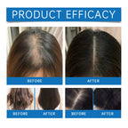 Rosemary Scalp Stimulating Hair Growth Serum Roller