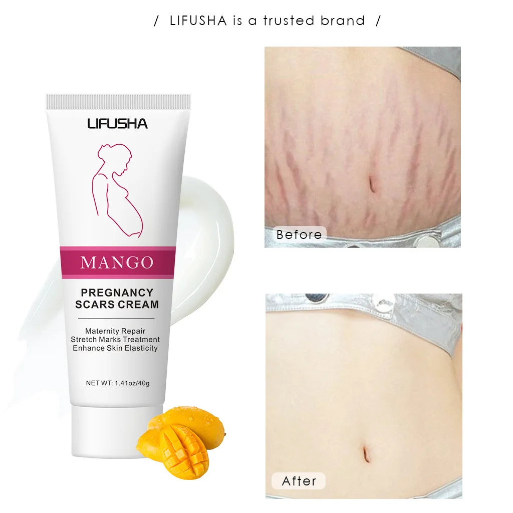 Mango Stretch Mark Cream and Repair Oil for Maternity Skin Care