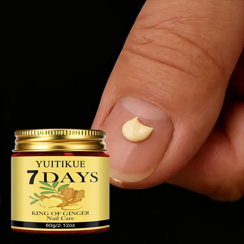 YUITIKUE Ginger Nail Repair Cream 60g Cuticle Nourishing Treatment