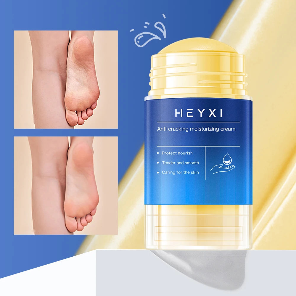 Heyxi Moisturizing Repair Balm Anti Cracking Cream for Hands and Feet - 6