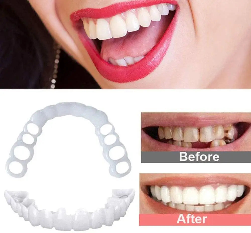 Snap On Smile Veneers Cosmetic Teeth Whitening Denture Set - 3