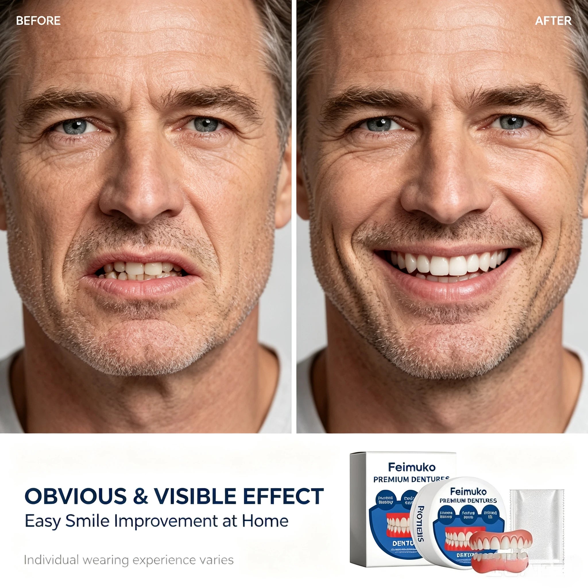 Snap-On Silicone Dentures for Natural Smile - 2