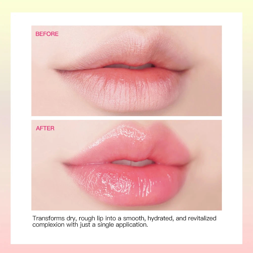 Hydrating Lip Balm for Dry and Cracked Lips - 4