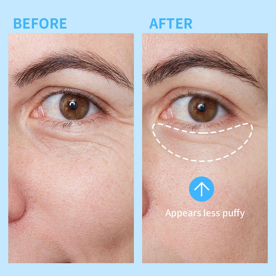 Cooling Eye Gel for Dark Circles and Puffiness
