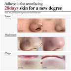 Salicylic Acid Pore Refining and Acne Repair Cream