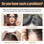 Water Ice Levin Root Activator Hair Growth Spray for All Hair Types