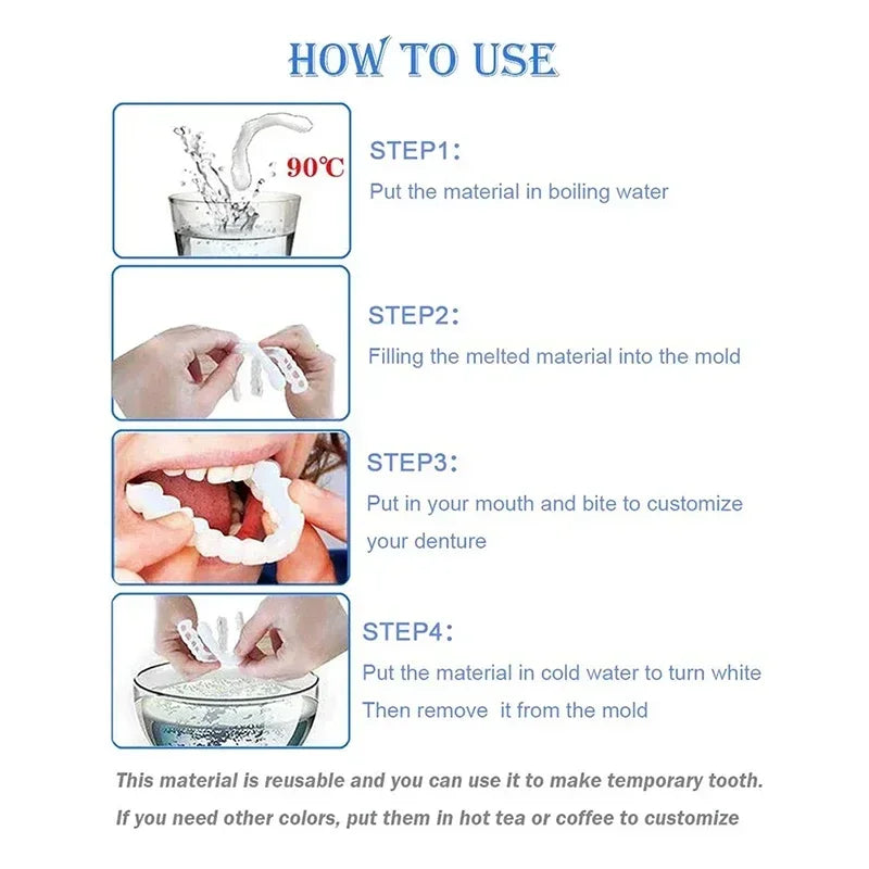 Snap-On Instant Smile Veneers for Temporary Teeth Whitening