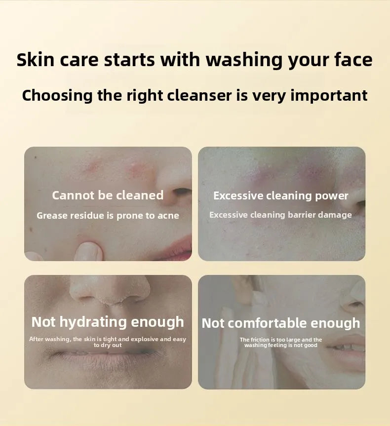 Sulfur Facial Cleanser Acne Control Oil Balancing Face Wash - 8