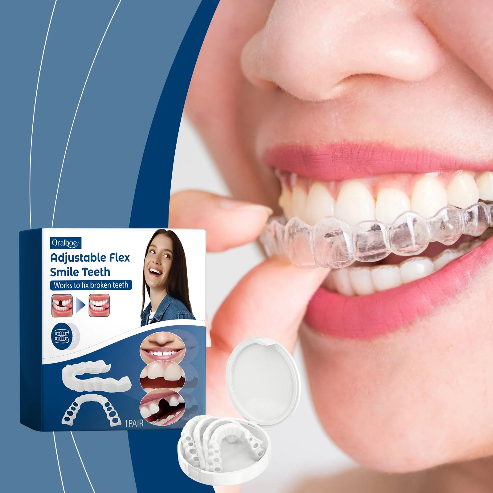 Adjustable Snap-On Smile Veneers for Missing Teeth - 2