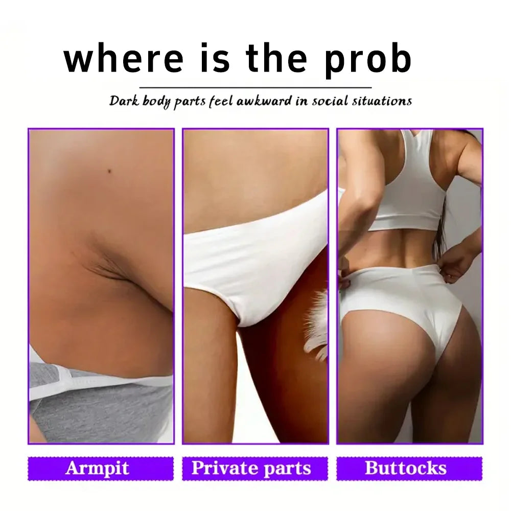 YUITIKUE Intimate Skin Whitening Cream Underarm and Inner Thigh Brightener