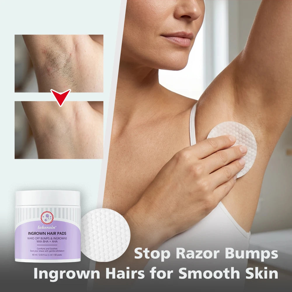 Ingrown Hair Treatment Pads for Razor Bumps and Shaving Irritation