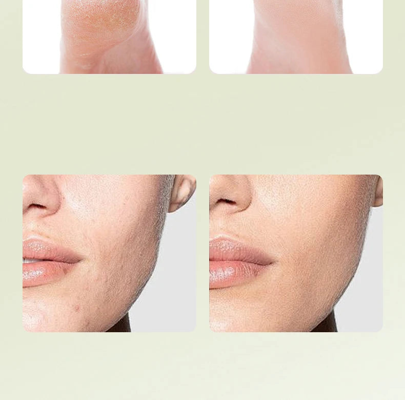 Avocado Moisturizing Balm Stick for Dry Cracked Hands and Feet - 20