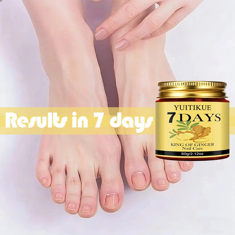 YUITIKUE Ginger Nail Repair Cream 60g Cuticle Nourishing Treatment