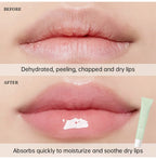 Moisturizing Lip Balm Butter for Soft Hydrated Lips