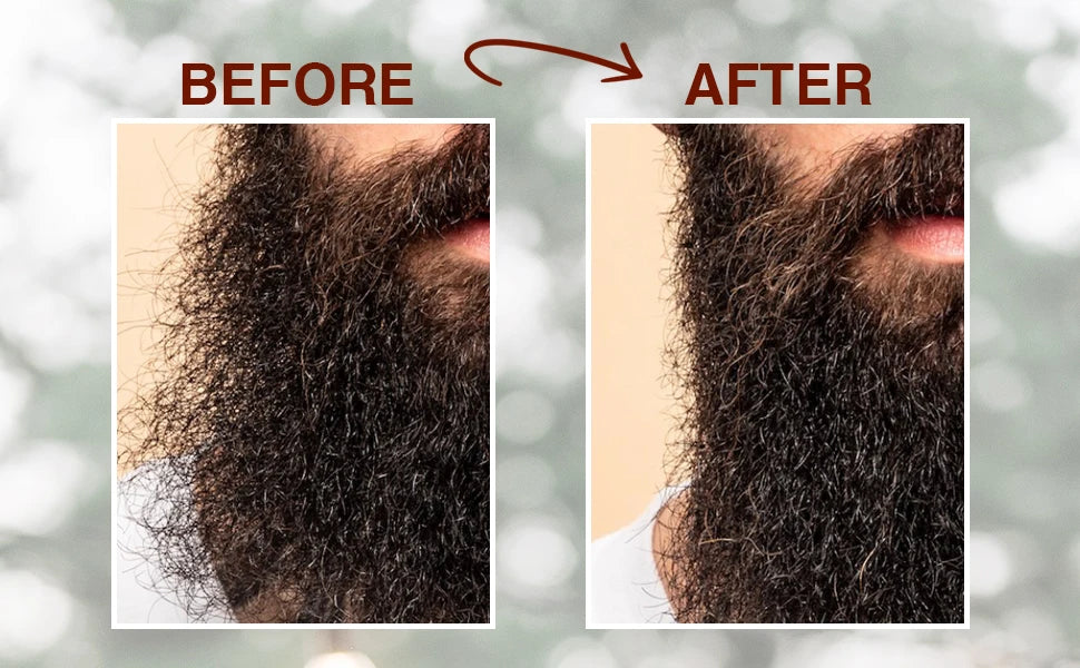 Goiple Beard Growth Care Kit Grooming Set for Men