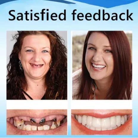 Custom Fit Silicone Dentures for Comfortable Smile - 5