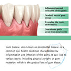 Herbal Toothache and Gum Relief Drops