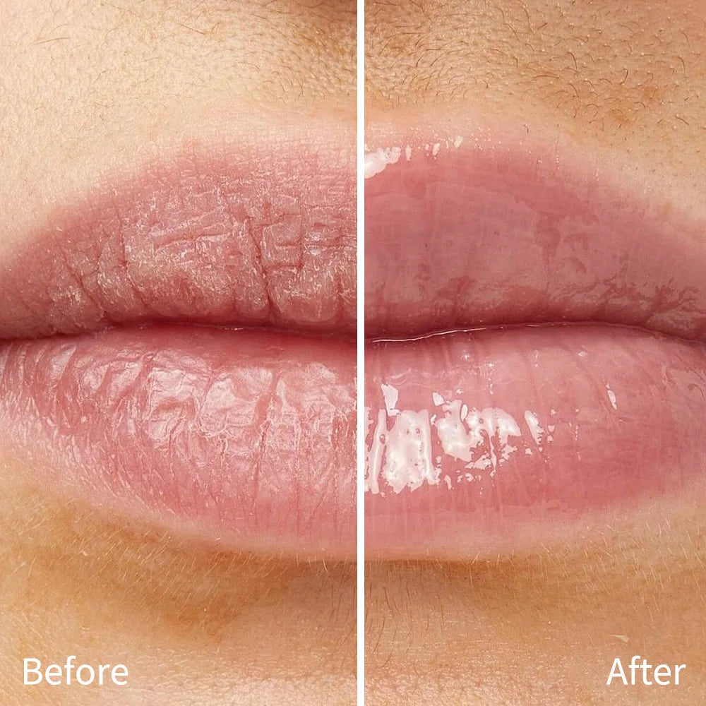 Hydrating Glossy Lip Balm with Glazed Finish - 5