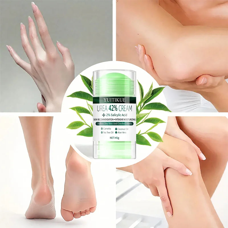 YUITIKUE 42% Urea Cream Moisturizer for Dry Cracked Skin and Heels - 5