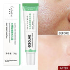 Salicylic Acid Pore Refining and Acne Repair Cream