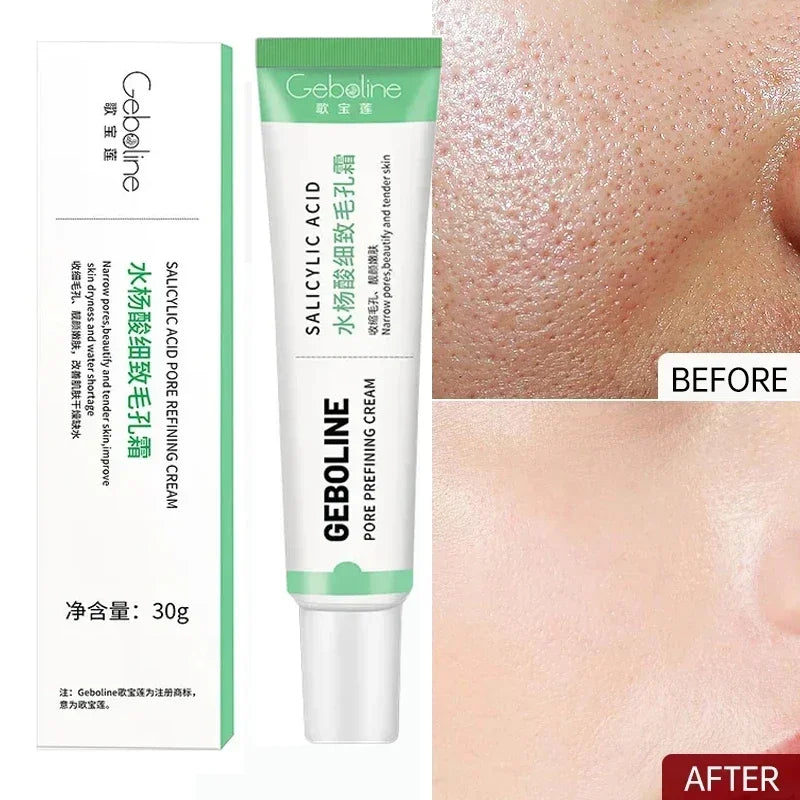 Salicylic Acid Pore Refining and Acne Repair Cream