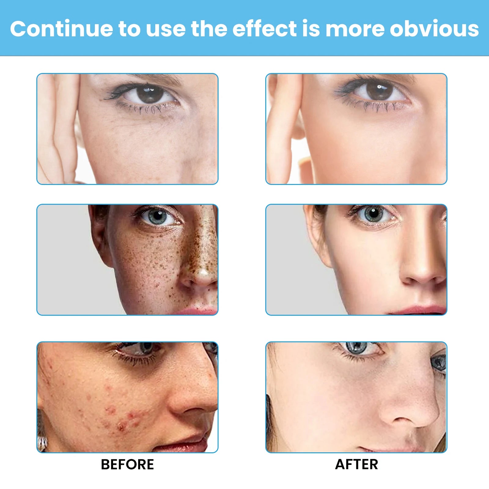 Brightening Face Cream Dark Spot Corrector and Skin Whitening Treatment - 4