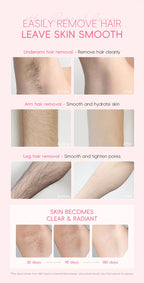 Gentle Painless Hair Removal Cream for Sensitive Body Areas