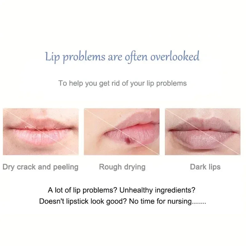 Brightening Lip Balm for Dark Melanin and Dry Lips - 7