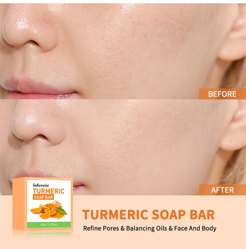 Turmeric Kojic Acid Brightening Soap Bar for Face and Body - 9