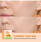Turmeric Kojic Acid Brightening Soap Bar for Face and Body