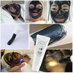 Carbon Laser Facial Gel for Skin Rejuvenation and Deep Pore Cleansing